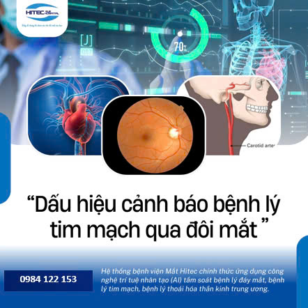 dau-hieu-thi-luc-nao-phan-anh-suc-khoe-cua-ban