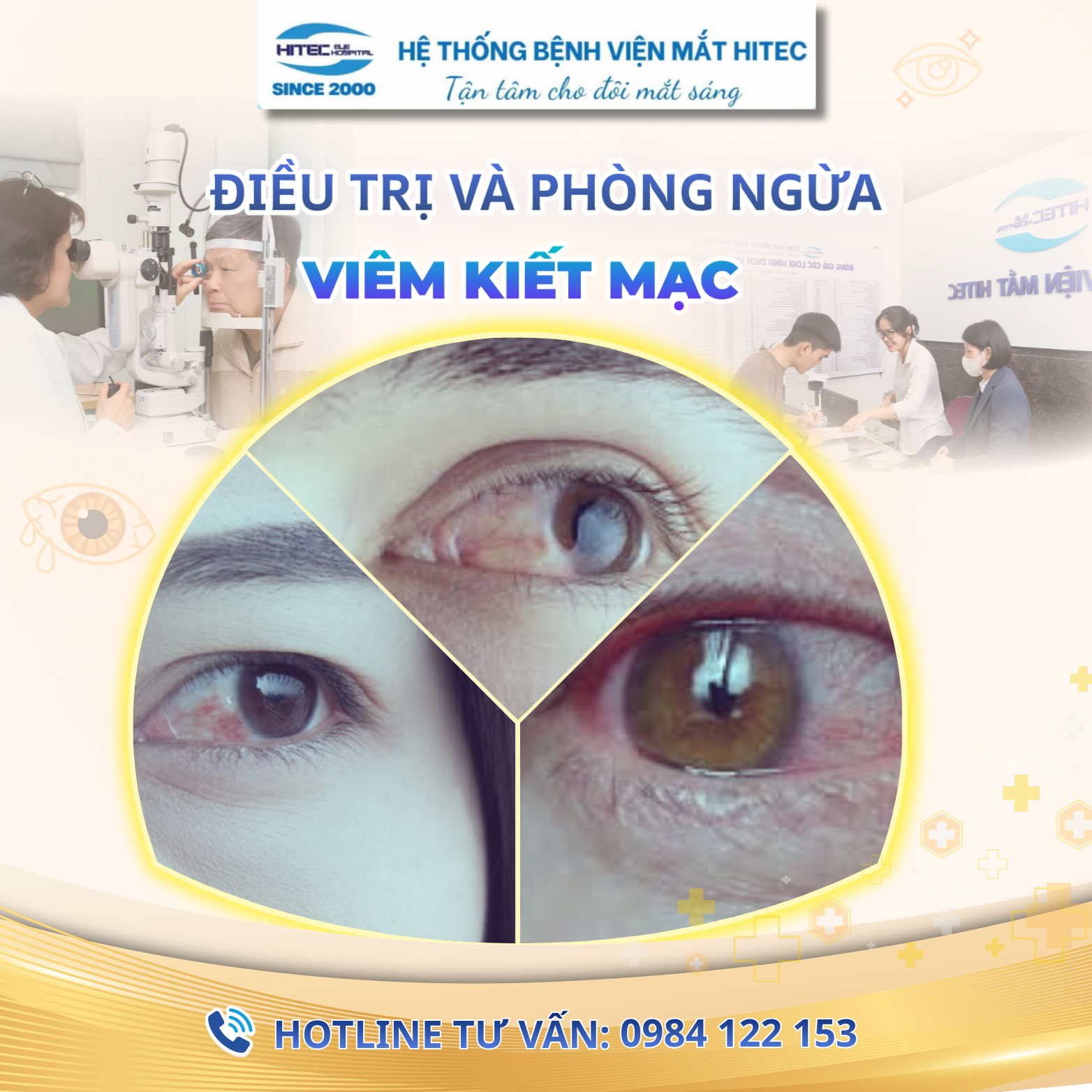 dau-mat-do-viem-ket-mac:-nguyen-nhan-trieu-chung-va-cach-dieu-tri