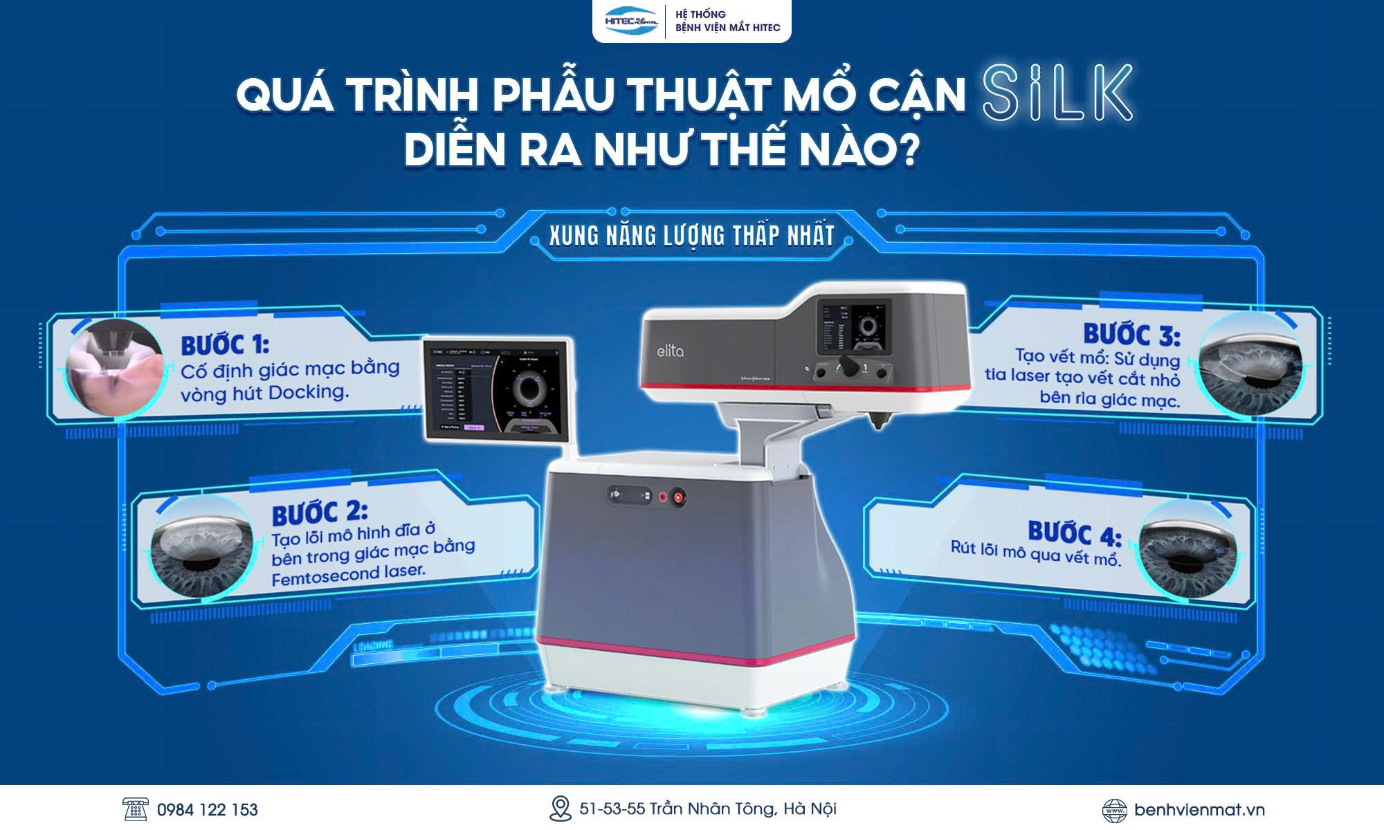 30-tuoi-co-nen-mo-mat-can-khong-giai-dap-chi-tiet